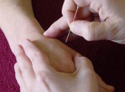 ALTERNATİF Konya Akupuntur Tedavisi, akupuntur kursu, manuel terapi, hacamat